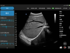 Elektronische konvexe Reihen-drahtloses Ultraschall-Gerät für Handy