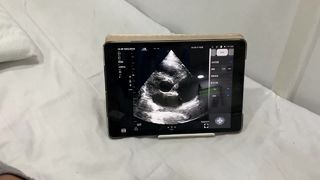 Drahtlose Doppelkopf-Ultraschallsonde für Herz und POCUS