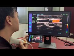 iTrason USB-Linear-Ultraschallsonde zur Verwendung auf Smartphone/PC