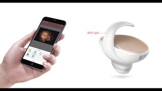 Marvoto Fetuskamera M1 – 3D-Hand-Ultraschall