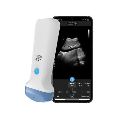 kaufen Drahtlose Wifi konvexe Sonde Digital mit Tiefe 378mm mit 128 Elementen online manufacture