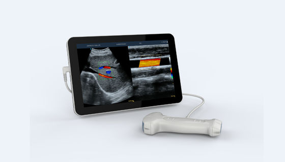 kaufen ultraschall-Scanner-Hochfrequenz des Doppelkopf-5V tragbare Hand online manufacture