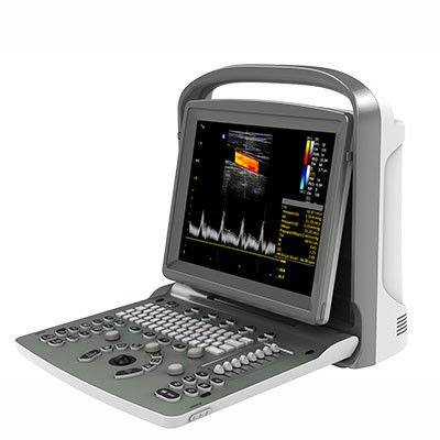 kaufen Tragbare Ultraschall-Maschine ECO6 12 Zoll-LED Chison mit langer Batteriedauer online manufacture