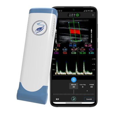 kaufen 12 MHz kabelloser Hand-Ultraschallscanner für iPhone und iPad | Elektronische Linear-Array-Farbdoppler-Sonde online manufacture