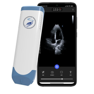 kaufen Drahtloser tragbarer Phased-Array-Ultraschallscanner, 5-MHz-Taschen-Herzultraschall für die POCUS-Echokardiographie online manufacture