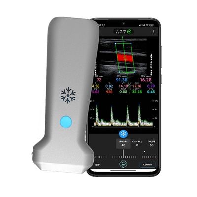 kaufen WiFi Wireless Linear Handheld Farbdoppler-Ultraschallscanner | 30 FPS Echtzeitbildgebung | Tragbare medizinische Ultraschallsonde online manufacture