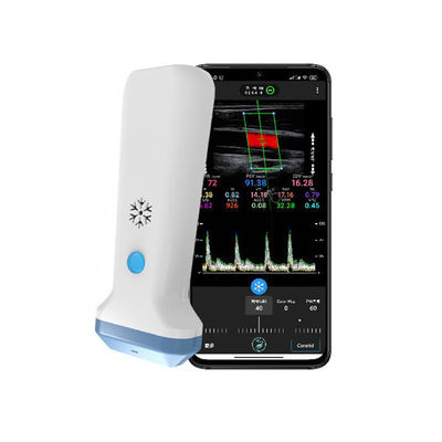 kaufen Drahtloser linearer Hand-Ultraschallscanner | 4/8,3/12 MHz tragbare Farbdoppler-Ultraschallsonde online manufacture