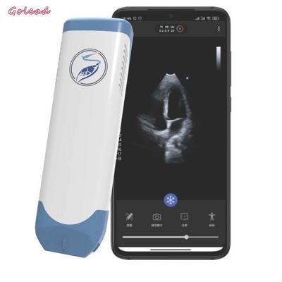 kaufen tragbare drahtlose Sonde des Ultraschall-3.6MHz in Phasen eingeteilt - Reihe Wandler online manufacture