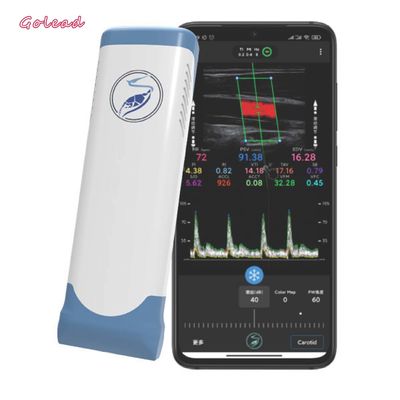 kaufen Elektronischer drahtloser tragbarer Ultraschall-Scanner 12MHz lineare Reihe Wifi online manufacture