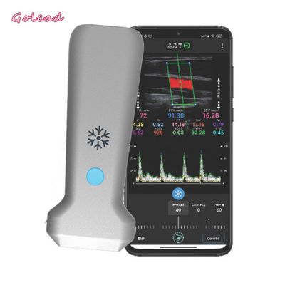 kaufen 126mm konvexer Sonden-Ultraschall-Scanner für Gefäß-MSK-Nerv online manufacture