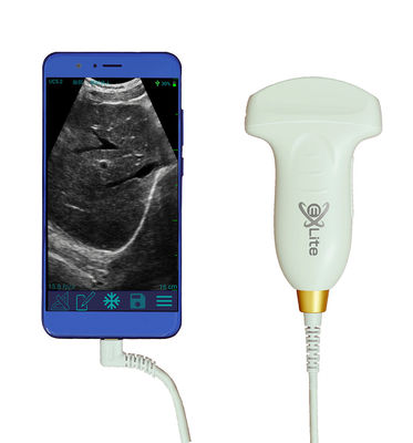 kaufen Elektronische konvexe Reihen-Farb-Doppler-Handultraschall-Scanner 3.5MHz online manufacture
