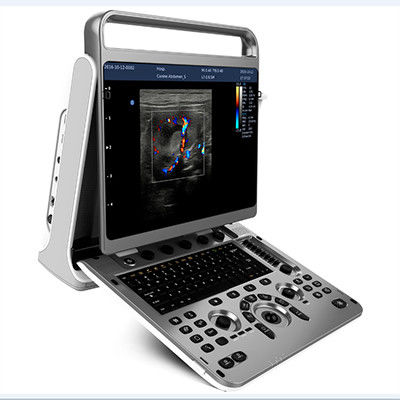 kaufen Ergonomischer Entwurfs-tragbare Ultraschall-Maschine Chison EBit 30 online manufacture