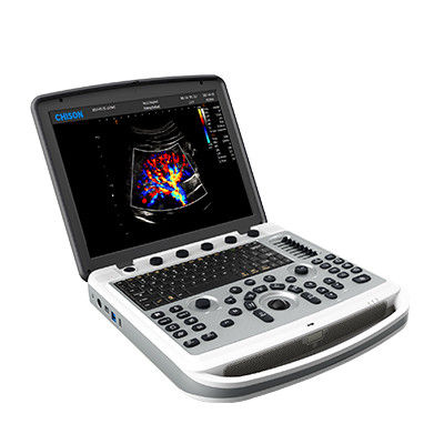 kaufen Laptop-Ultraschall-Maschine 120° drehbare Chison SonoBook 6 tragbare online manufacture