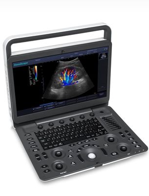 kaufen Ultraschall-Maschine BW-Ultraschall 15.6inch LED Sonoscape E1 Exp online manufacture