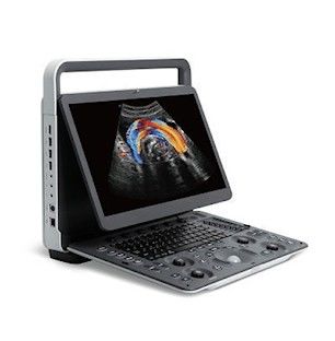 kaufen Panoramische tragbare Ultraschall-Promaschine Darstellung SonoScape E2 online manufacture