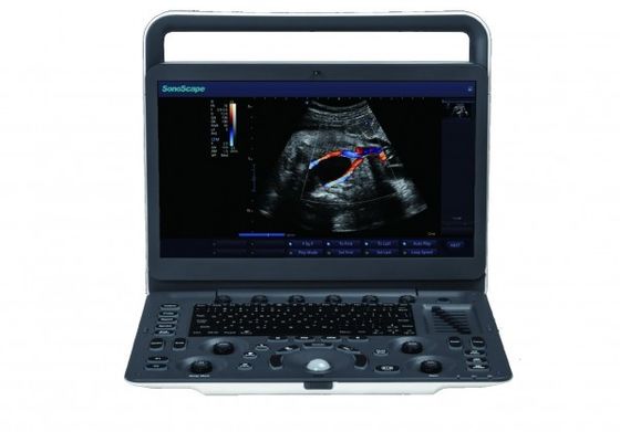kaufen 7 tragbare Ultraschall-Maschine Darstellungs-Niveaus SonoScape E3 mit dem 15,6 Zoll-Monitor online manufacture