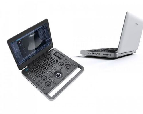 kaufen Smart visieren Laptop 500GB SonoScape-Ultraschall-Maschine mit 15,6“ LCD an online manufacture