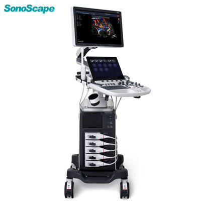 kaufen Ultraschall-Maschine P50 500GB SonoScape mit fünf Sockeln online manufacture
