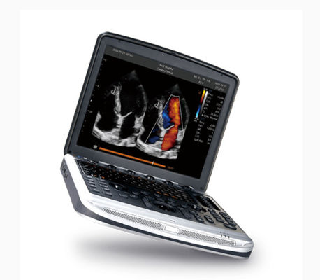 kaufen FDA-gebilligte Laptop-Ultraschall-Maschine Chison SonoBook 8 für Echokardiografie online manufacture