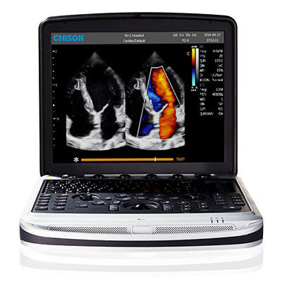 kaufen Einfach, Laptop-Ultraschall-Maschine 4D Chison SonoBook 9 zu tragen online manufacture