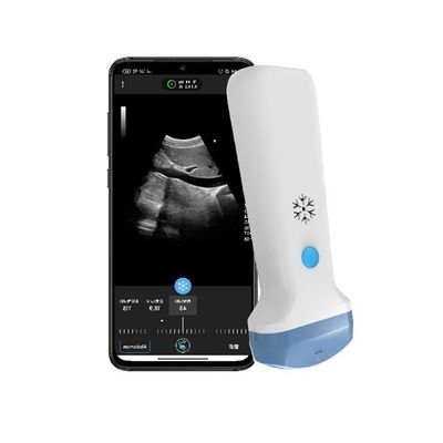 kaufen HDMI-Ausgang drahtloser konvexer Handheld Ultraschall-Scanner 3,6 MHz tragbarer Farb-Doppler POCUS Ultraschall online manufacture