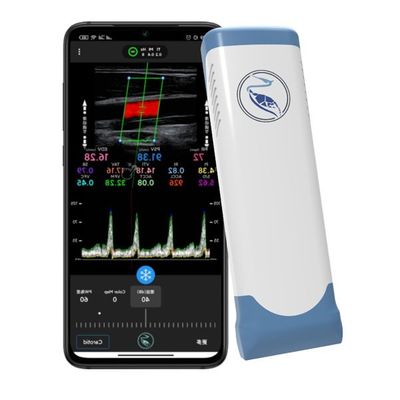 kaufen Felder des Echo Color Doppler Wireless Handheld-Ultraschall-Scanner-100 online manufacture