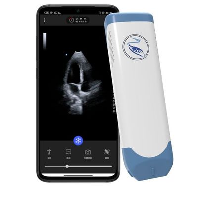 kaufen Handultraschall-Scanner der Tiefen-18.9cm für Iphone 3.6MHz online manufacture
