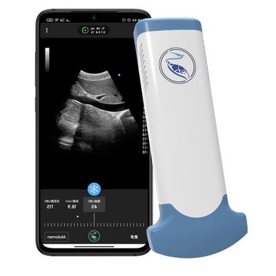 kaufen Handultraschall-Scanner der Notmedizin-MPEG-4 für klinischen Diagnosegebrauch online manufacture