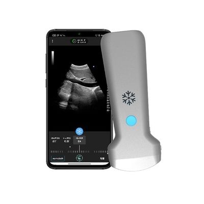kaufen ISO13485 Drahtloser konvexer Hand-Ultraschallscanner | Tragbare Farbdoppler-Ultraschallsonde online manufacture