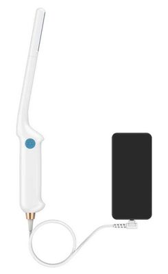 kaufen Elektronische lineare Reihen-Schaf-Ultraschall-Scanner-Maschine 350g online manufacture