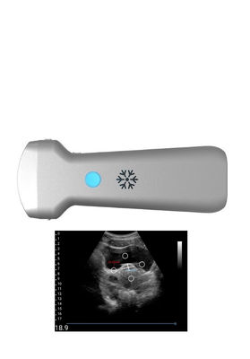 kaufen Konvexe drahtlose Ultraschall-Sonde Ultrasonication für Gynäkologie online manufacture