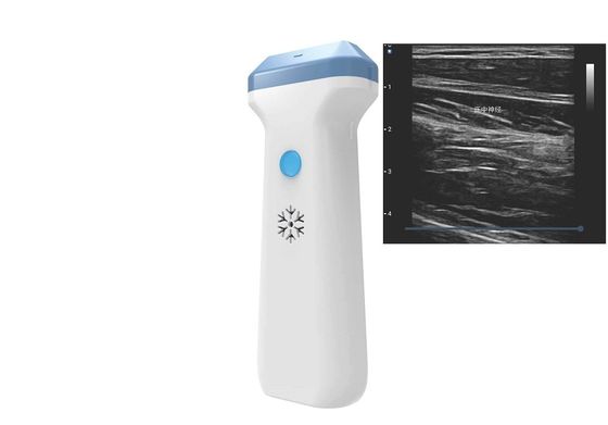 kaufen Wifi-Ultraschall-Sonde 80 To180dB Element DICOM BMP-png-JPEG 128 online manufacture