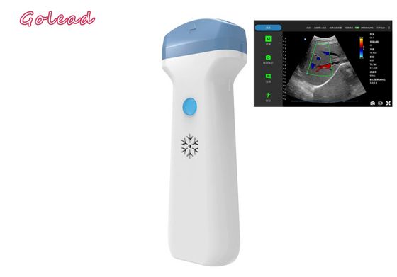 kaufen Drahtlose Ultraschall-Sonde Anästhesie Ipad für POCUS-Prüfungs-Grundversorgung online manufacture