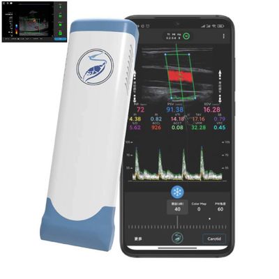 kaufen 256 Scan-Linien Ipad-Ultraschall-Wandler-drahtlose Ultraschall-Sonde für PICC online manufacture