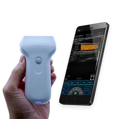 kaufen CE-zugelassene drahtlose tragbare Ultraschallsonde mit 96 Elementen für die klinische Diagnose im Krankenhaus online manufacture