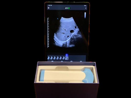 kaufen Effiziente Handheld Ultraschallprobe für die Anwendung in der Intensivmedizin online manufacture
