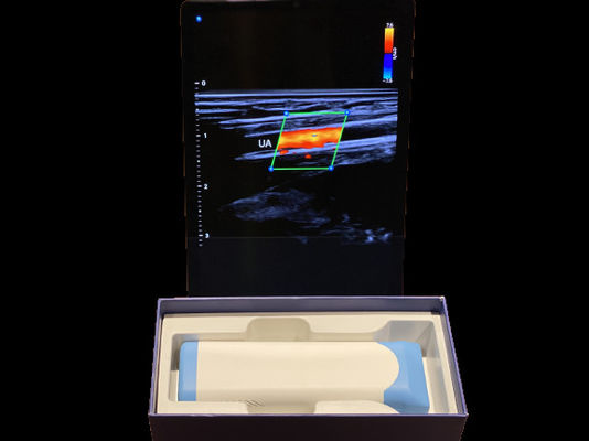 kaufen Erweiterter Handheld-Ultraschall-Scanner 0,2 kg mit 3000 mAh-Batterie für medizinische Zwecke online manufacture