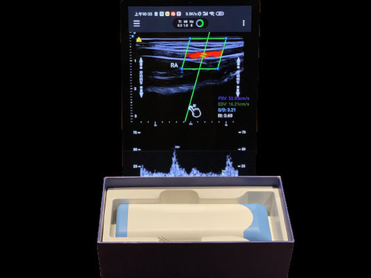 kaufen Elektronischer Linear-Array Handheld Ultraschall-Scanner mit 2 Stunden Arbeitszeit online manufacture