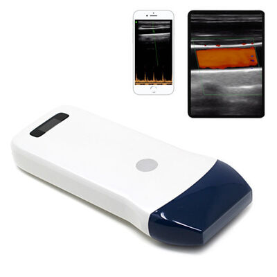 kaufen Drahtloser Linearsonden-Ultraschallscanner für Gefäßzugänge, Nervenblockaden und muskuloskelettale Bildgebung online manufacture