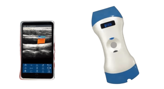 kaufen Drahtlose tragbare Ultraschallsonde mit 128 Elementen und zwei Köpfen – eine Sonde für Tiefenbildgebung, oberflächliche Bildgebung und Point-of-Care-Diagnose online manufacture