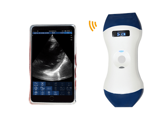 kaufen FDA CE ISO13485 handtellergroße drahtlose Hand-Ultraschallsonde mit Phased Array und linearem Doppelkopf für POCUS online manufacture