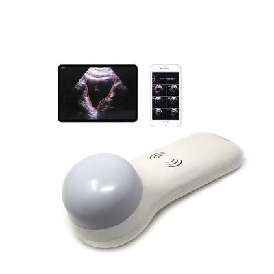 kaufen Drahtloser tragbarer 4D-Blasenscanner für die Urinvolumenmessung am Behandlungsort online manufacture