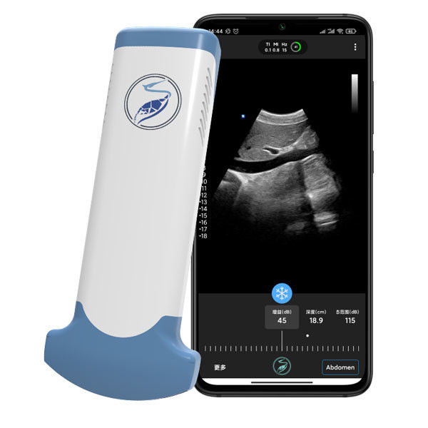 CER markierte Ultraschall-Scanner JPEG BMP-png MPEG-4 3.6MHz tragbares Wifi