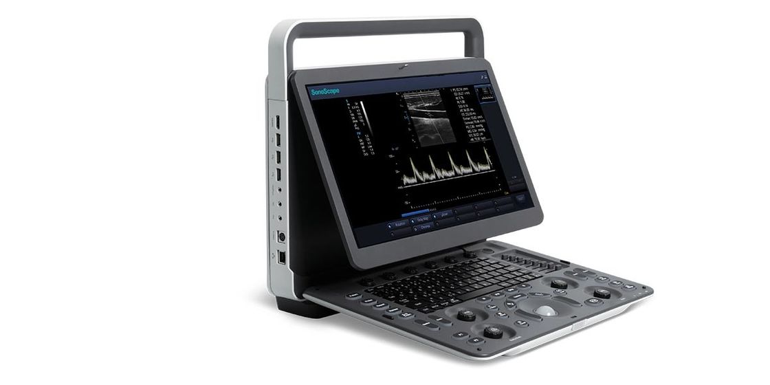 15,6 Zoll LED SonoScape tragbarer Farb-Doppler-Ultraschall-Maschine BW-Ultraschall