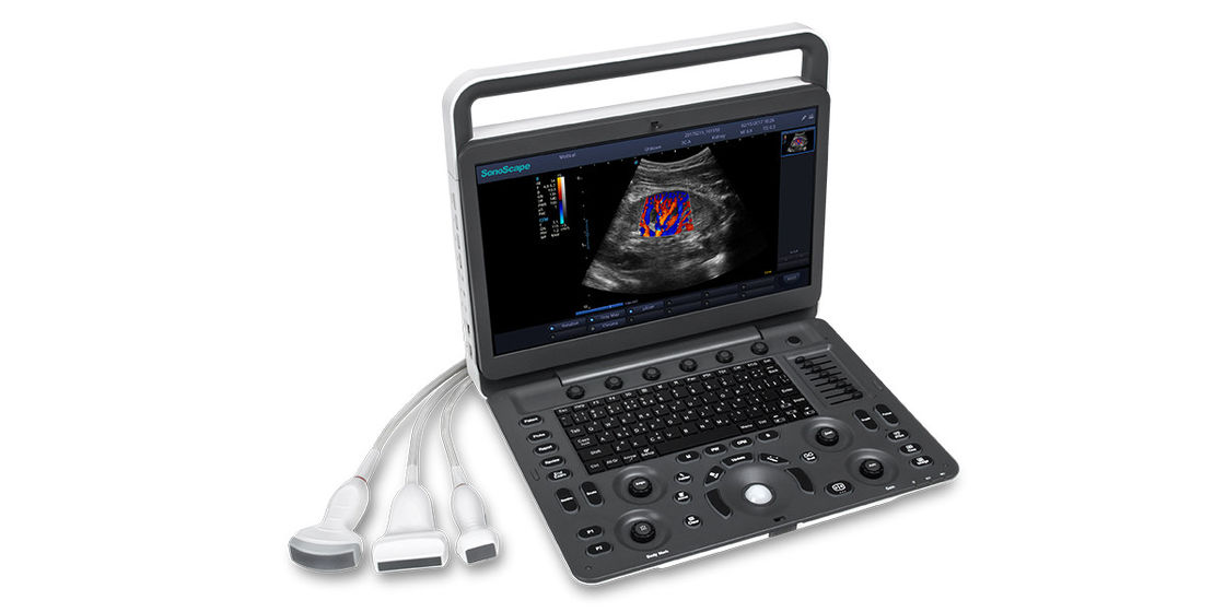 7 tragbare Ultraschall-Maschine Darstellungs-Niveaus SonoScape E3 mit dem 15,6 Zoll-Monitor