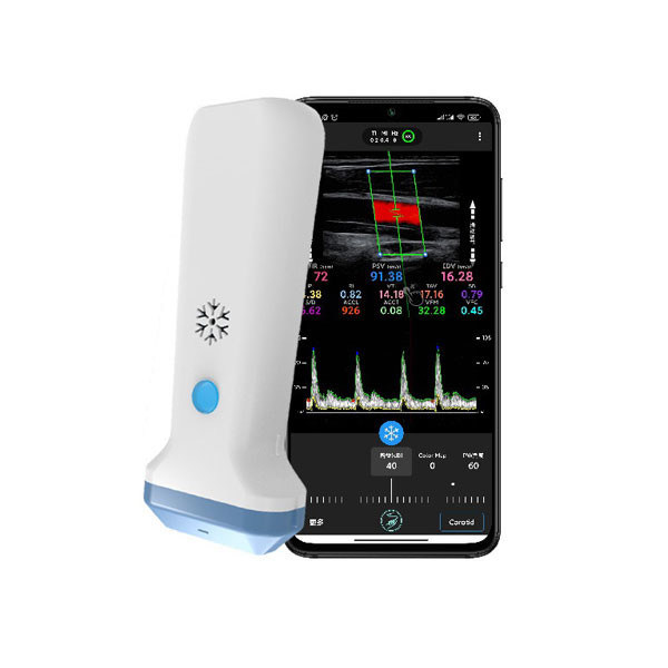 Drahtloser linearer Hand-Ultraschallscanner | 4/8,3/12 MHz tragbare Farbdoppler-Ultraschallsonde