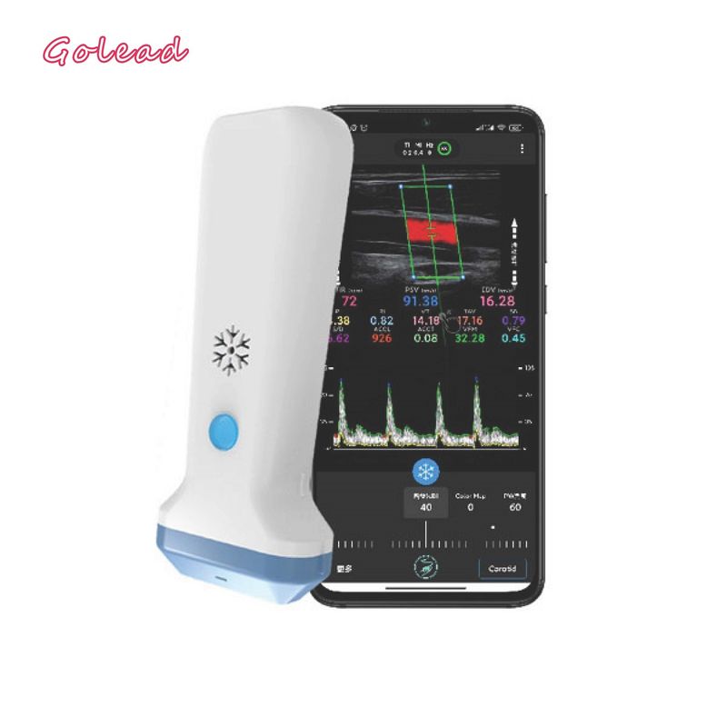 Radioapparat-sondenartiger Ultraschall-Scanner 12MHz 3000mAh für Iphone