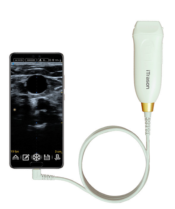 64 Kanal 20mm Tiefe Handheld Ultraschall-Scanner für periphere vaskuläre Beurteilung und Ultraschall-geführte vaskuläre Zugang