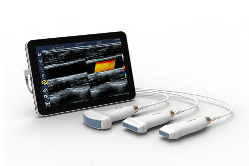 tragbarer drahtloser Android Ultraschall-Scanner 10MHz mit Art-c Verbindung