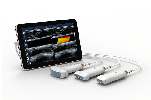 USB Typ-C Linearer Hand-Ultraschallscanner 10 MHz Tragbare Android-Ultraschallsonde für Gefäß- und POCUS-Geräte